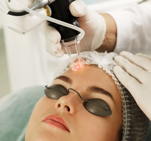 Fractional CO2 Laser Treatment Cost for Smooth Skin Refinement