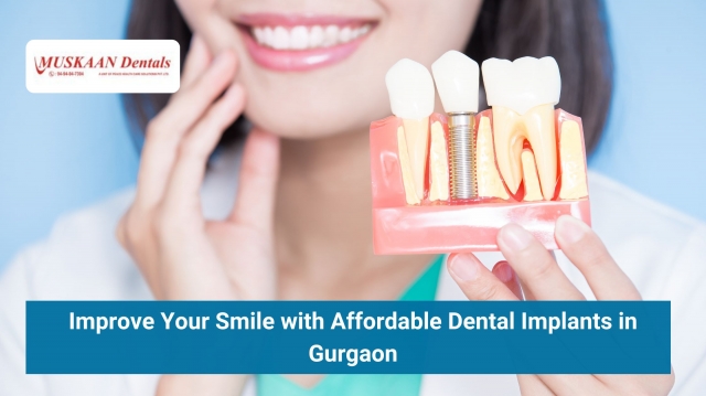 Improve Your Smile with Affordable Dental Implants in Gurgaon