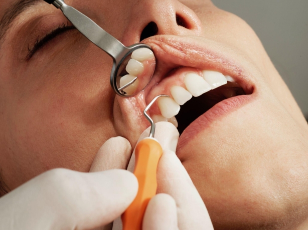 Overcoming Dental Anxiety: Tips for Nervous Patients