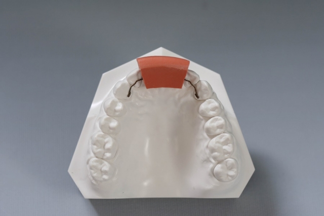 What Is Dental Putty and What Is It Used For?