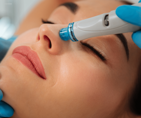 Is Hydrafacial the Best Treatments for Blackheads?