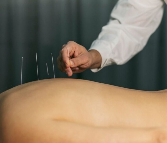 Dry Needling Pakenham