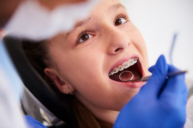 The Role of the Orthodontist: Why Expert Care is Essential for a Perfect Smile