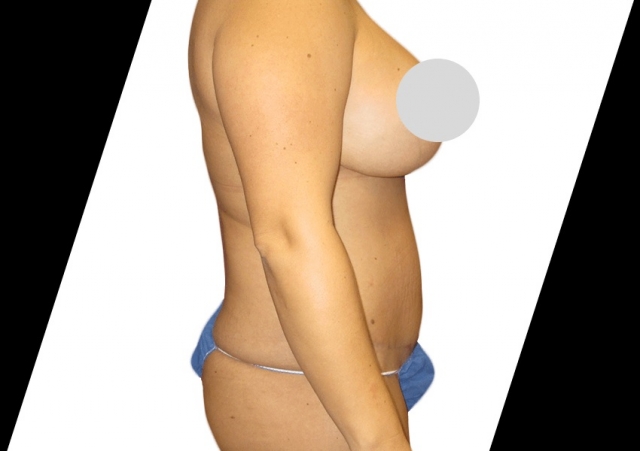 How Does Premier Plastic Surgery Ensure Patient Safety and Care?