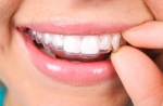 The Clear Path to a Straighter Smile: Exploring Invisalign Options in Louisville CO