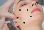 At What Age Does Botox Stop Working? Insights for Riyadh Clients: