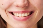 Can Dental Stain Removal Help with Yellow Teeth?