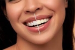 Can I Whiten My Teeth If I Have Fillings or Crowns?