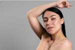 Unveiling the Secrets of Skin Tag Removal: Expert Tips and Tricks