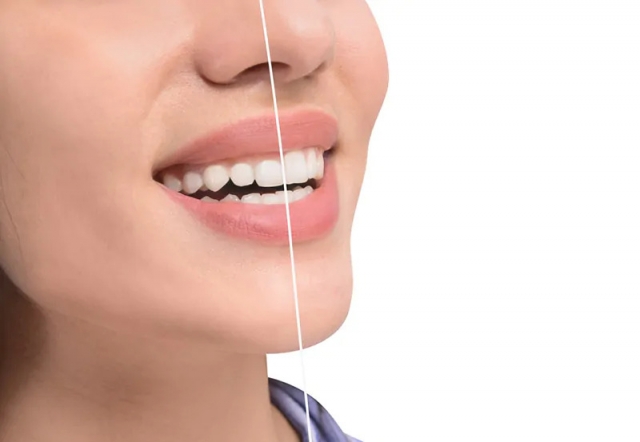 Say Goodbye to the “Gummy Smile”: How Gum Contouring Can Perfect Your Smile