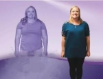 Sleeve Gastrectomy in Dubai: A Safe and Effective Weight Loss Solution