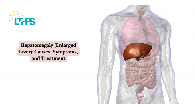 Hepatomegaly (Enlarged Liver): Causes, Symptoms, and Treatment