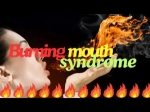 Can Supplements Really Help Burning Mouth Syndrome? Experts Reveal the Truth