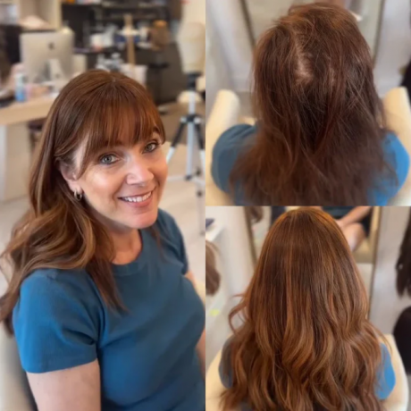 The Ultimate Guide to Choosing a Luxury Hair Topper: Confidence, Comfort, and Style Combined