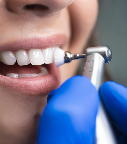 Beyond Brushing: Essential Dental Services for Total Oral Care