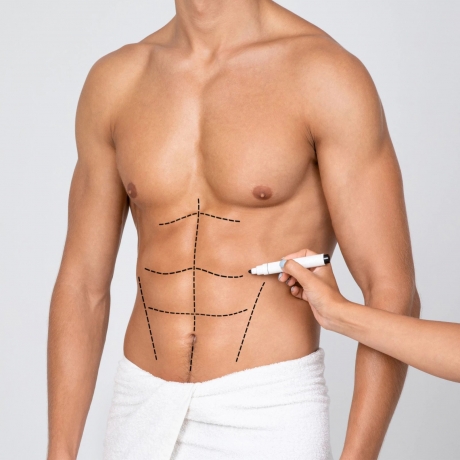 Choosing a Skilled Surgeon: The Key to a Successful Liposuction Procedure