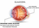 Unveiling the Potential of Stem Cell Therapy for Eyes in India