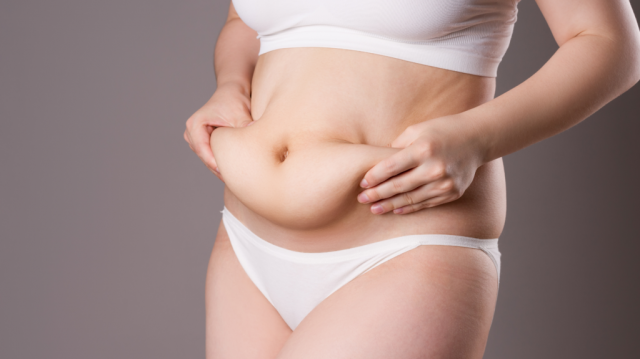 When Diet and Exercise Aren't Enough: Exploring Tummy Tuck Options