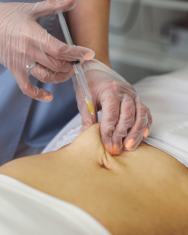 Transform Your Body With Lemon Bottle Injection A Modern Approach To Safe And Effective Fat Reduction