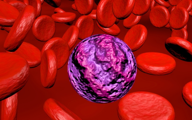 Acute Myeloid Leukemia Market Size and Growth Driven by Innovative Therapeutics