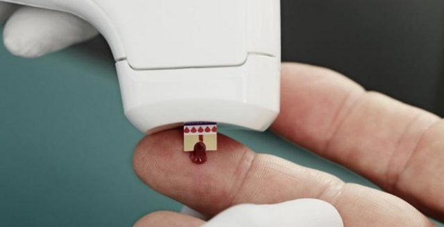 Coagulation Analyzers Market Growth Driven by Advanced Automation Trends