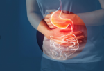 Gastrointestinal Therapeutics Market Size, Share and Growth Forecast 2025-2033