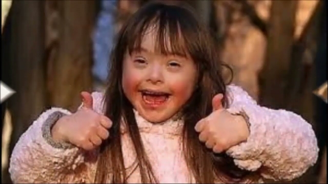 Down Syndrome Market Growth Dynamics and Key Trends to 2032