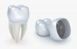 What to Expect When Getting a Dental Crown