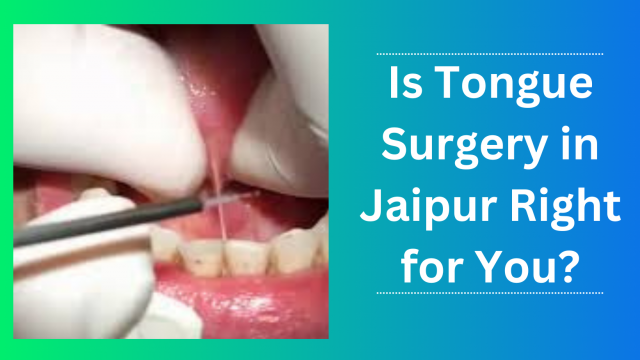 Is Tongue Surgery in Jaipur Right for You?