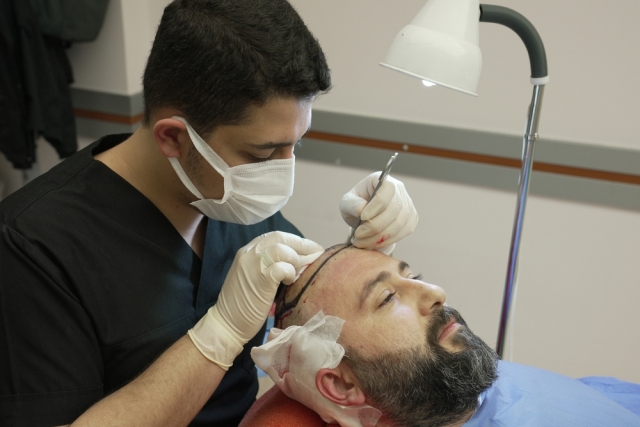 FUE Hair Transplant in Islamabad: Restoring Confidence and Hairlines