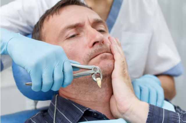 Beyond CPAP: Exploring the Effectiveness of Sleep Apnea Jaw Surgery