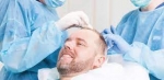 Elevate Your Look: Best Hair Transplant in Islamabad