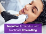 Fractional RF: A Revolutionary Approach to Skin Rejuvenation