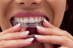 Dental Delights: Unmasking the Best Dentist in Delray Beach!