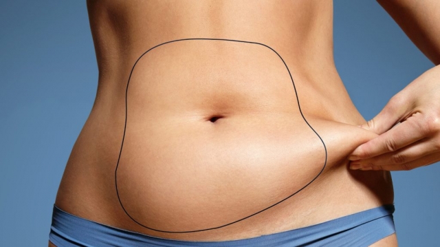 Unmatched Precision: Liposuction Techniques in Islamabad Revealed