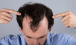 Hair Fall Prevention: Strategies and Treatments in Dubai