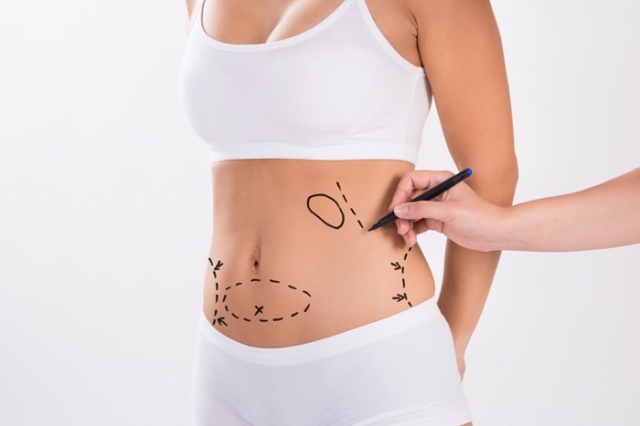 Liposuction Cost in Riyadh, Saudi Arabia