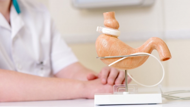 The Role of Minimally Invasive Techniques in Bariatric Surgery