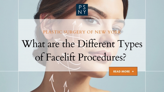 Facelift Procedure