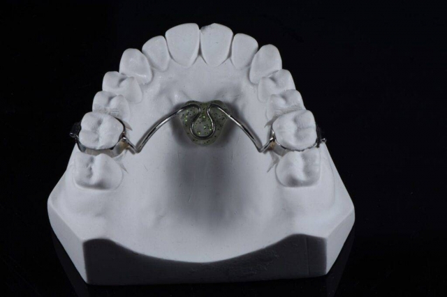 Streamline Your Dental Practice with China Outsource Dental Lab - Your Trusted Partner for Quality Dental Solutions