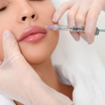 What should I consider before getting Russian Lip Fillers in Dubai?