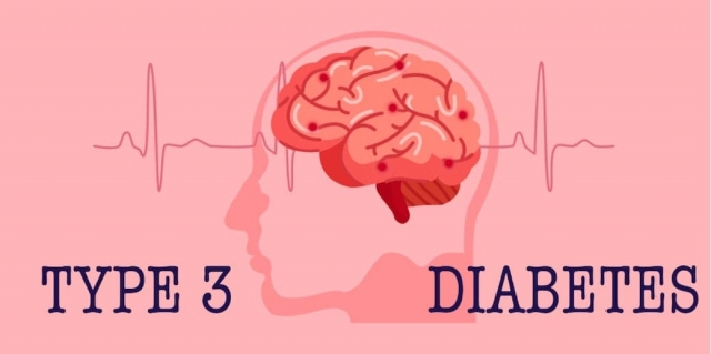 5 Key Symptoms of Type 3 Diabetes You Shouldn't Ignore