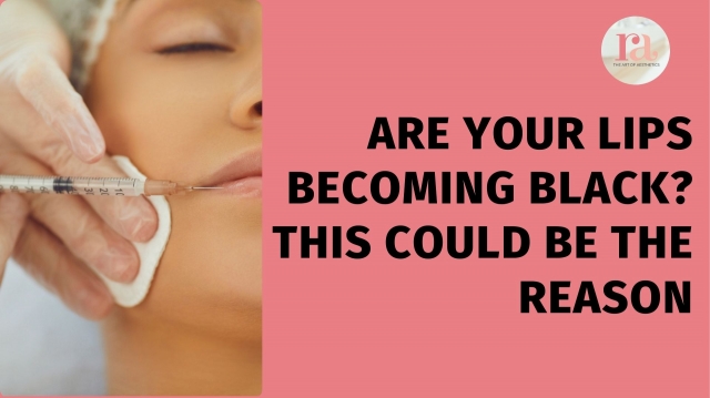 Are Your Lips Becoming Black? This Could Be the Reason