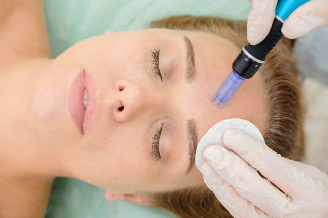 Glow Up in Dubai: Microneedling for Radiant Skin