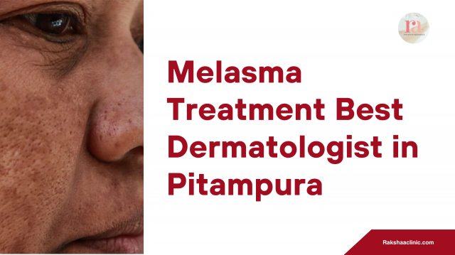 Melasma Treatment Best Dermatologist in Pitampura