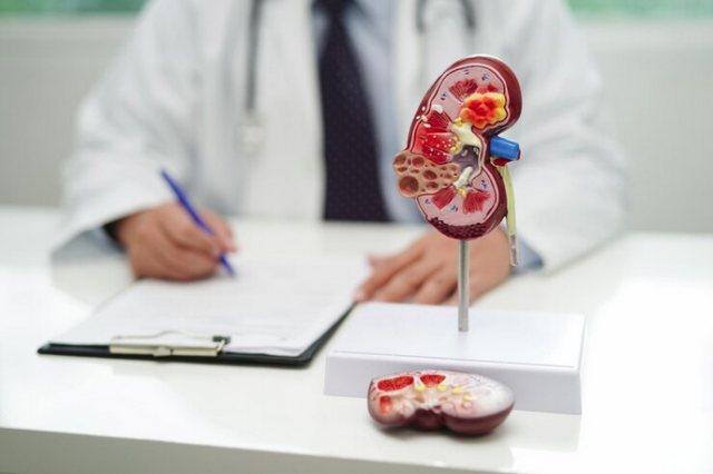 Counting the Cost: Private Kidney Stone Removal Expenses in the UK