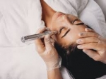 3 Advanced Treatments Dermatologists Trust To Fade Hyperpigmentation