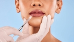 Get the Celebrity Look: Lip Fillers in Oman