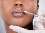 From Budget to Luxury: Lip Fillers Cost in Muscat
