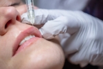 Muscat’s Best Lip Filler Clinics: A Comprehensive Guide